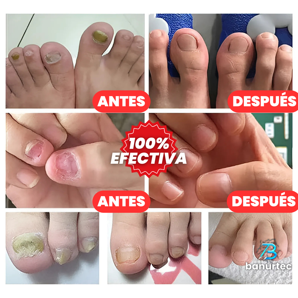Oferta Especial 2x1: 7 Days Nails™ Endurecedor y Reparador de Uñas
