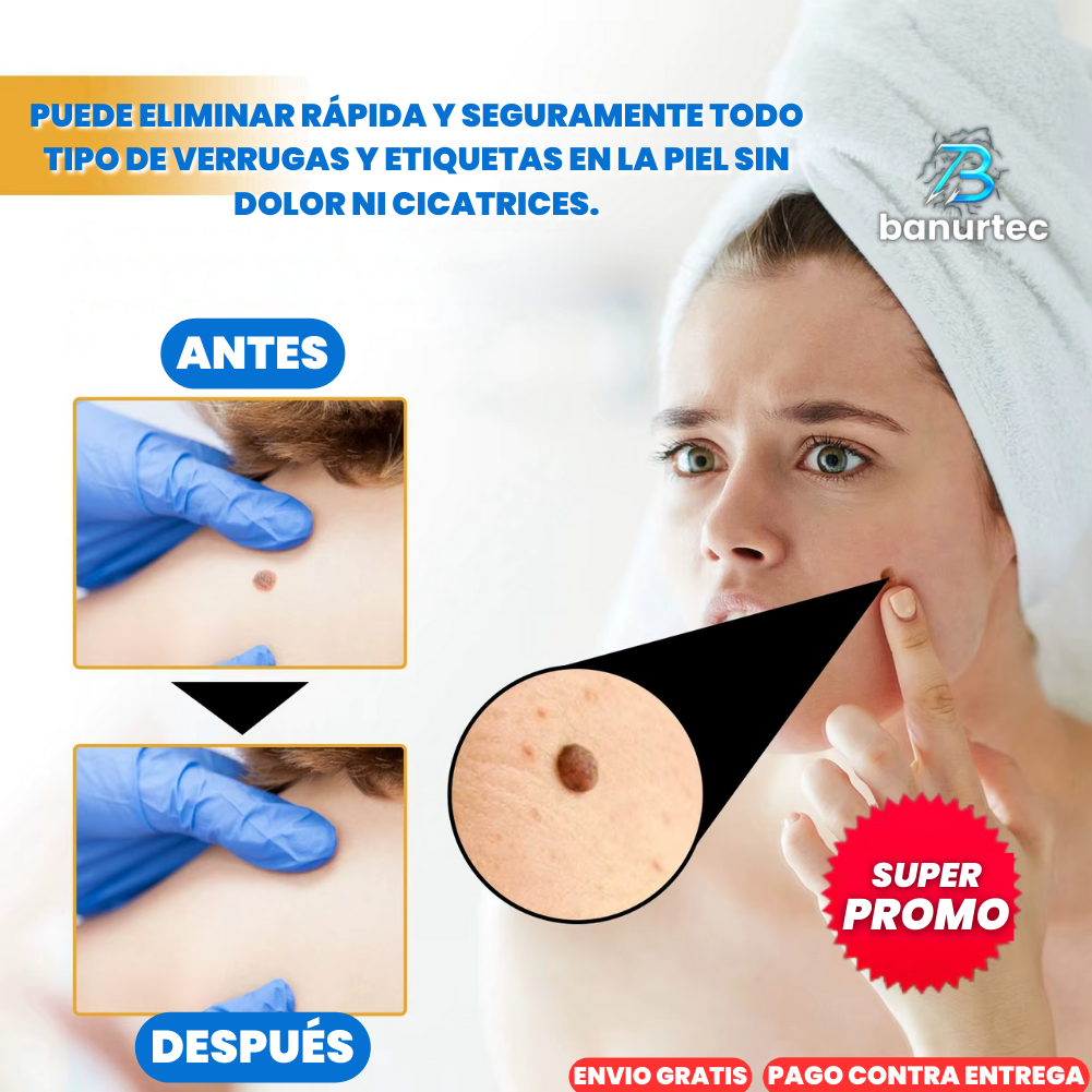 Oferta Especial 2x1: Tag Recede™ Eliminador de Verrugas Instantáneo