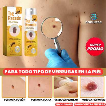 Oferta Especial 2x1: Tag Recede™ Eliminador de Verrugas Instantáneo