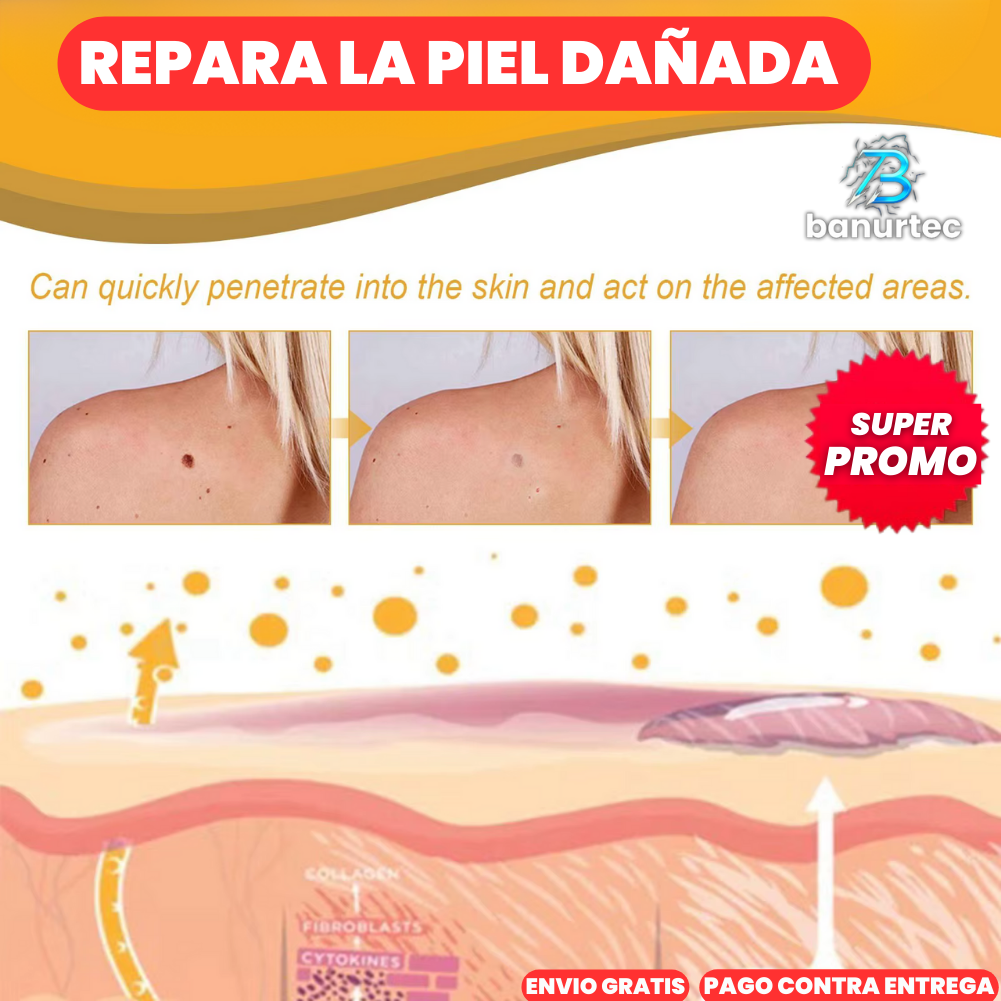 Oferta Especial 2x1: Tag Recede™ Eliminador de Verrugas Instantáneo