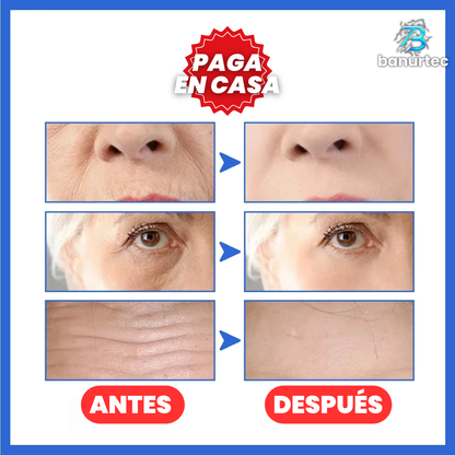 Botox Stock Solution™  Serum Antiarrugas, Reafirmante Rejuvenecedor