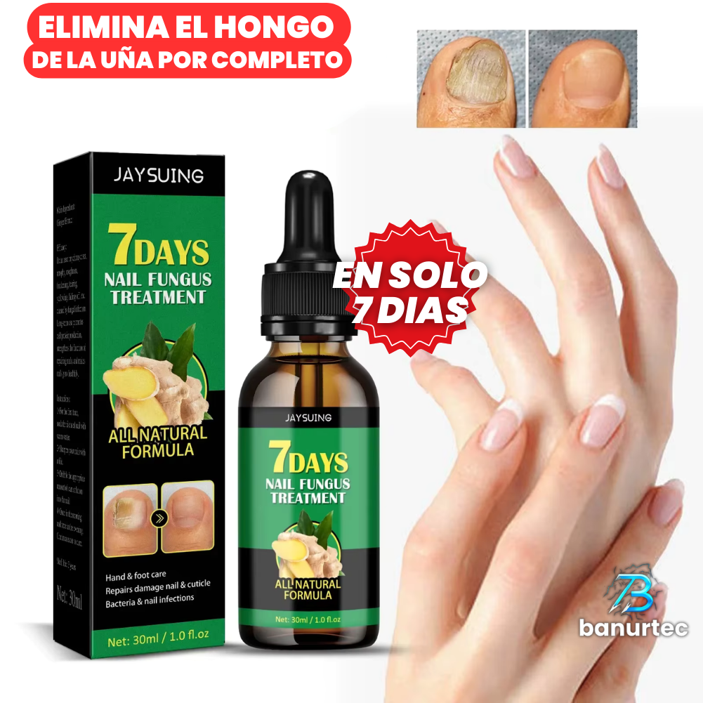 Oferta Especial 2x1: 7 Days Nails™ Endurecedor y Reparador de Uñas