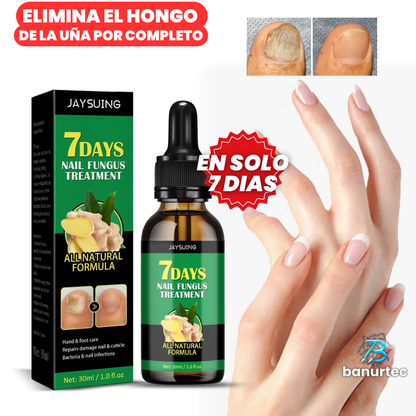 Oferta Especial 2x1: 7 Days Nails™ Endurecedor y Reparador de Uñas