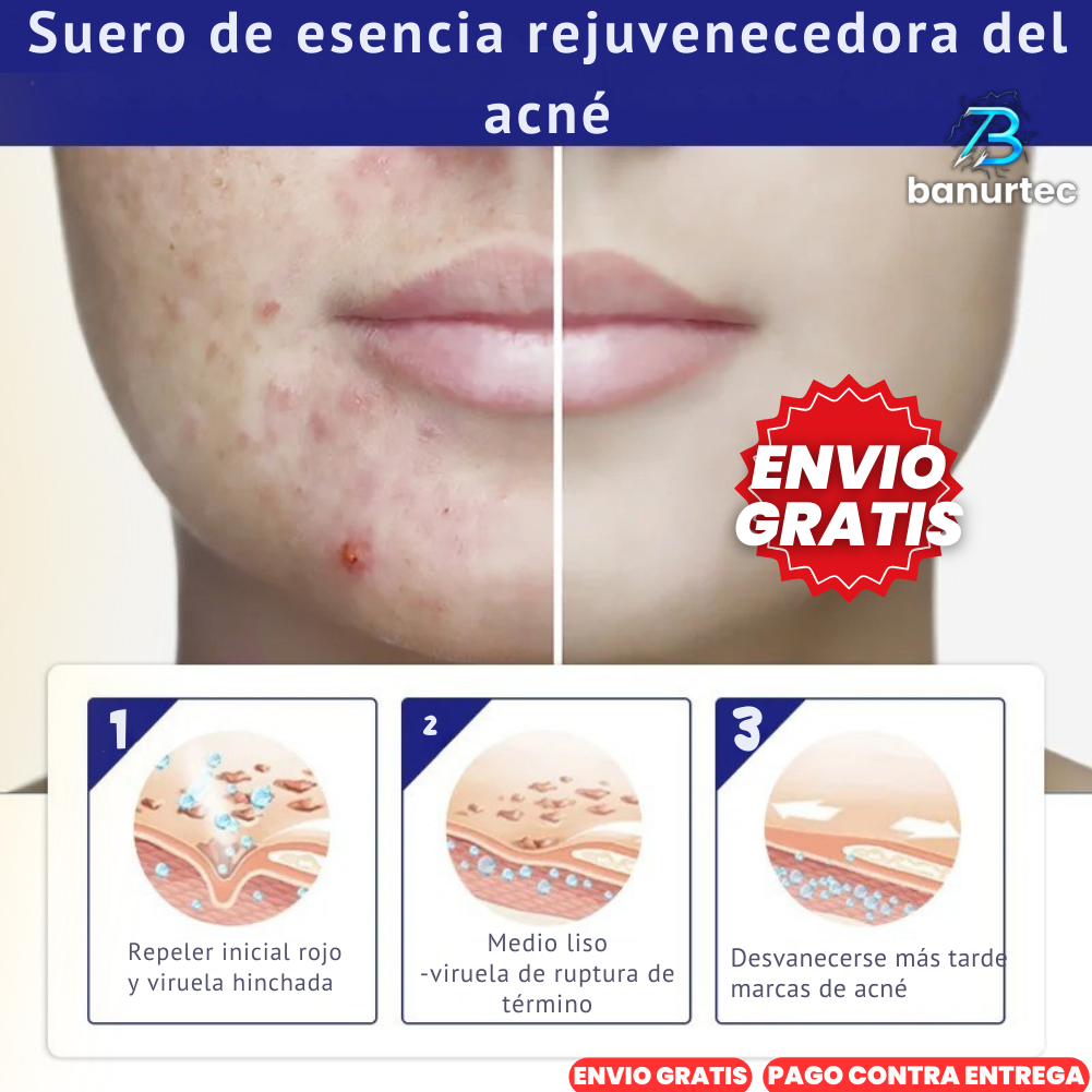 The Ordinary™ Niacinamida Serum Anti Acné Reduce Arrugas Y Lineas De Expresión