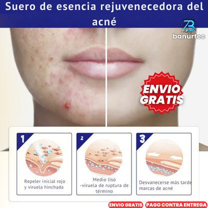 The Ordinary™ Niacinamida Serum Anti Acné Reduce Arrugas Y Lineas De Expresión