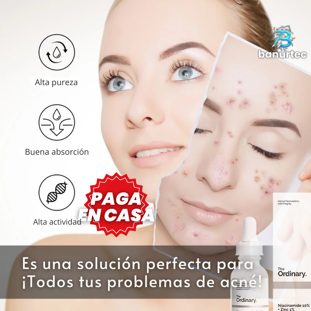 The Ordinary™ Niacinamida Serum Anti Acné Reduce Arrugas Y Lineas De Expresión