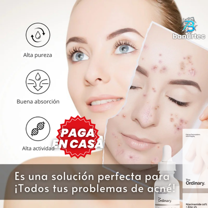 The Ordinary™ Niacinamida Serum Anti Acné Reduce Arrugas Y Lineas De Expresión