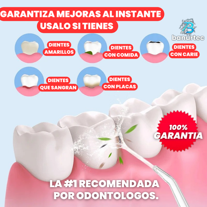 Irrigador Oral Recargable De Alta Presión Waterpik Pro