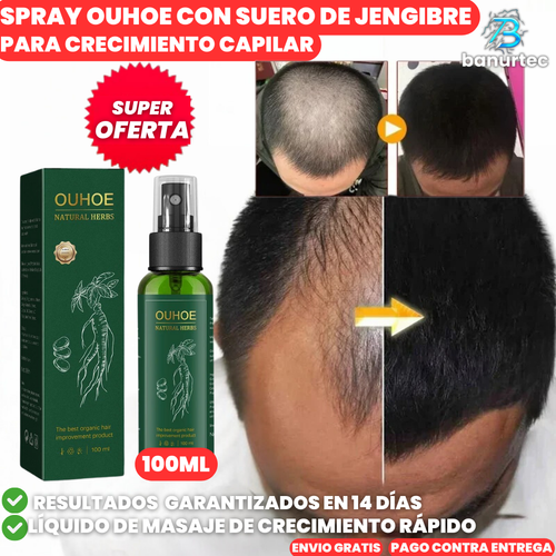 Ouhoe™ Spray Con suero De Jengibre Para Crecimiento Capilar