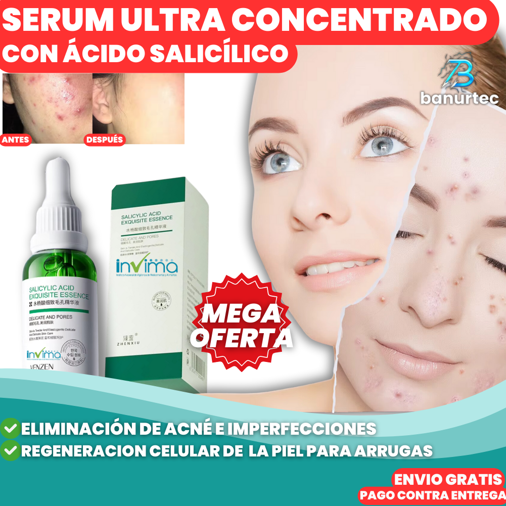 Niaglow S10™ | Serum Anti Acné Ultra Concentrado con Ácido Salicílico